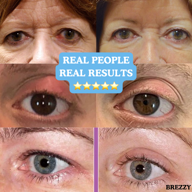 Brezzy™ 2.0 : Get rid of dry, irritated eyes in just 4 minutes with this new eye massager